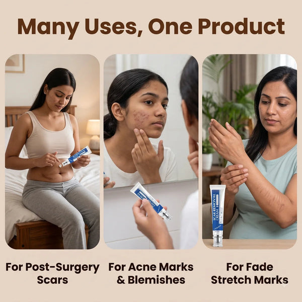 Scar Removal Cream | Keloid & Stretch Mark Care | Softening & Flattening